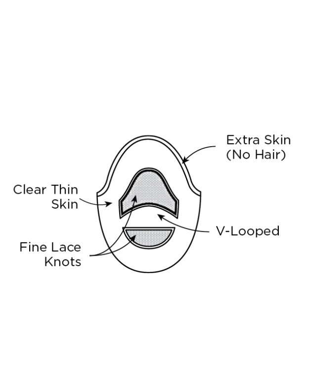 Trend II Lite Cap Construction