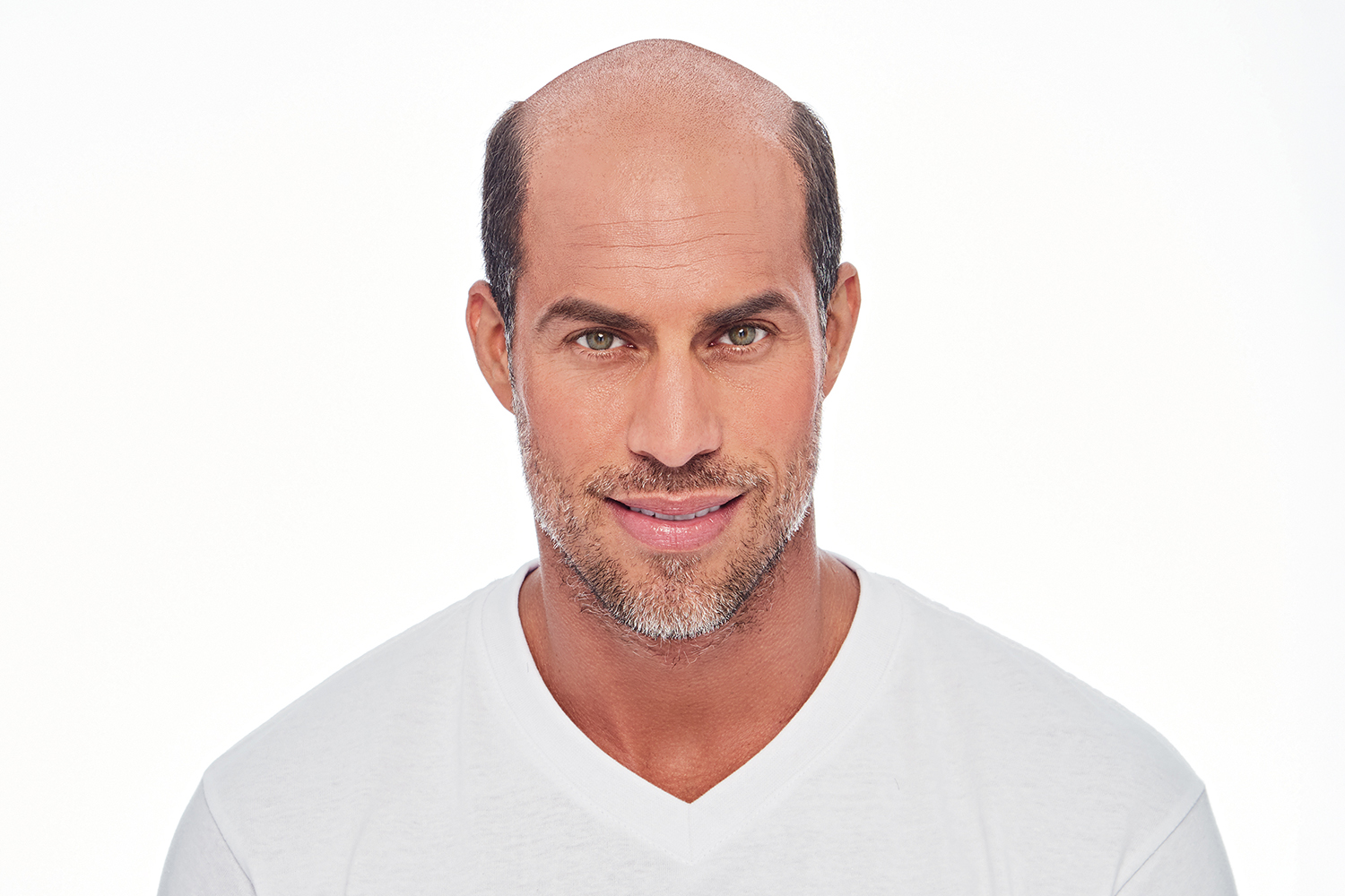 AHL - WIlliam - Model - Before 1 - B&A